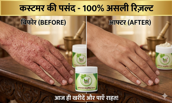 KGN AYURVEDA antifungal Ayurvedic Kit