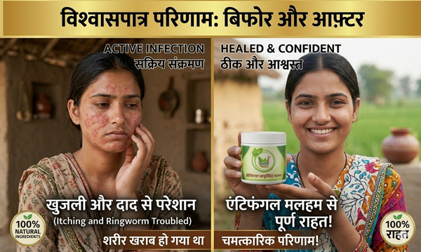 KGN AYURVEDA antifungal Ayurvedic Kit